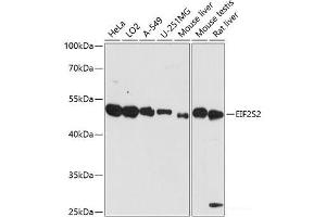 Western blot analysis of extracts of various cell lines using EIF2S2 Polyclonal Antibody at dilution of 1:3000. (EIF2S2 抗体)