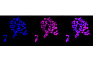 anti-Baculoviral IAP Repeat-Containing 5 (BIRC5) antibody