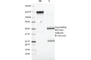 SDS-PAGE (SDS) image for anti-Solute Carrier Family 3 (Activators of Dibasic and Neutral Amino Acid Transport), Member 2 (SLC3A2) antibody (ABIN6940598)
