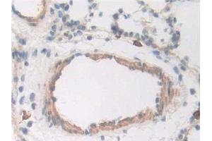Detection of CD163 in Rat Trachea Tissue using Polyclonal Antibody to Cluster Of Differentiation (CD163) (CD163 抗体  (AA 693-939))