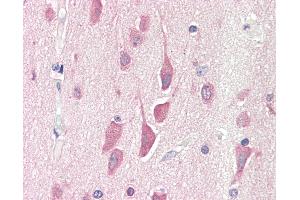 Anti-HPS6 antibody IHC staining of human brain, cortex. (HPS6 抗体  (AA 455-466))