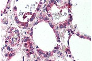 Human Thyroid (formalin-fixed, paraffin-embedded) stained with MRGPRF antibody ABIN399998 at 10 ug/ml followed by biotinylated goat anti-rabbit IgG secondary antibody ABIN481713, alkaline phosphatase-streptavidin and chromogen. (Mrgprf 抗体  (N-Term))