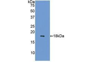 Detection of Recombinant SST, Mouse using Polyclonal Antibody to Somatostatin (SST) (Somatostatin 抗体  (AA 27-116))