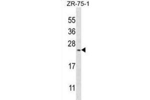 Western Blotting (WB) image for anti-BARX Homeobox 1 (BARX1) antibody (ABIN3003109) (BARX1 抗体)
