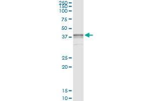 Immunoprecipitation of BST1 transfected lysate using anti-BST1 monoclonal antibody and Protein A Magnetic Bead , and immunoblotted with BST1 MaxPab rabbit polyclonal antibody. (BST1 抗体  (AA 1-318))