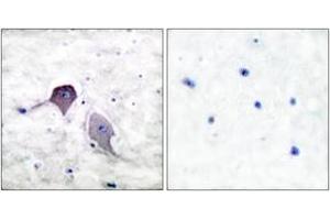 Immunohistochemistry analysis of paraffin-embedded human brain tissue, using Presenilin 1 Antibody. (Presenilin 1 抗体  (AA 1-50))