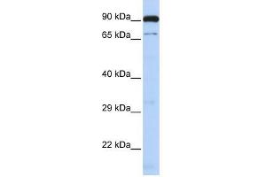 CTCFL antibody used at 1. (CTCFL 抗体  (N-Term))