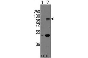 Image no. 2 for anti-P-Cadherin (CDH3) (C-Term) antibody (ABIN357039) (P-Cadherin 抗体  (C-Term))