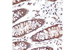 Immunohistochemistry of paraffin-embedded human colon using STK39 Rabbit mAb (ABIN1682890, ABIN3015922, ABIN3015923 and ABIN7101461) at dilution of 1:100 (40x lens). (STK39 抗体)