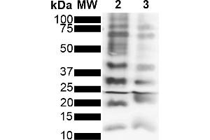 Western Blot analysis of Purified poly-ubiquitin chains showing detection of Multiple Ubiquitin protein using Rabbit Anti-Ubiquitin Monoclonal Antibody, Clone FK2 (ABIN5695851). (Ubiquitin 抗体  (FITC))