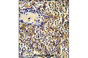 Formalin-fixed and paraffin-embedded human tonsil tissue reacted with CCL3 Antibody , which was peroxidase-conjugated to the secondary antibody, followed by DAB staining. (CCL3 抗体  (C-Term))