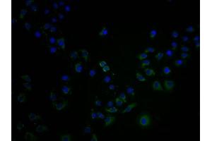 Immunofluorescence staining of A549 cells with ABIN7139992 at 1:100, counter-stained with DAPI. (OR4C15 抗体  (AA 258-268))