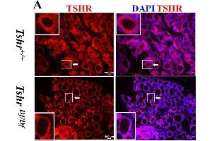 Immunofluorescence showed expression alteration of thyroid specific genes.
