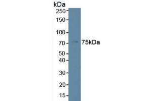 Detection of PLCb2 in Human K562 Cells using Polyclonal Antibody to Phospholipase C Beta 2 (PLCb2) (Phospholipase C beta 2 抗体  (AA 1-250))
