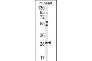 RN Antibody (Center) (ABIN654316 and ABIN2844098) western blot analysis in mouse heart tissue lysates (35 μg/lane). (RNF183 抗体  (AA 86-114))