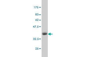 Western Blot detection against Immunogen (35.