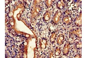 Immunohistochemistry of paraffin-embedded human small intestine tissue using ABIN7143509 at dilution of 1:100 (ARL4D 抗体  (AA 2-201))
