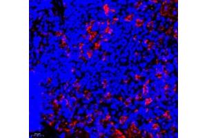 Immunofluorescence of paraffin embedded rat spleen using ANXA3 (ABIN7073065) at dilution of 1: 300 (400x lens) (Annexin A3 抗体)