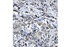 IHC analysis of EIF4A1 using anti-EIF4A1 antibody (ABIN7603143).