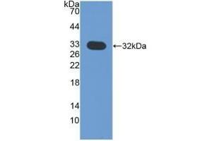 Detection of Recombinant CHIT1, Mouse using Polyclonal Antibody to Chitinase 1 (CHIT1) (Chitotriosidase 1 抗体  (AA 210-464))