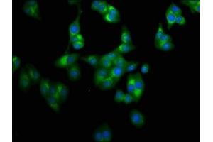 Immunofluorescence staining of HepG2 cells with ABIN7158788 at 1:100, counter-stained with DAPI. (LAPTM4A 抗体  (AA 181-233))