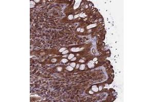 Immunohistochemical staining of human rectum with TTLL10 polyclonal antibody  shows moderate cytoplasmic positivity in glandular cells at 1:50-1:200 dilution. (TTLL10 抗体)