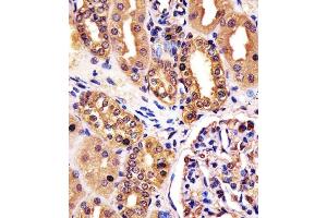 (ABIN6242612 and ABIN6578254) staining RNF7 in human kidney tissue sections by Immunohistochemistry (IHC-P - paraformaldehyde-fixed, paraffin-embedded sections). (RNF7 抗体  (N-Term))