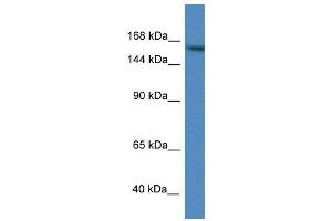WB Suggested Anti-ZBTB40 AntibodyTitration: 1. (ZBTB40 抗体  (N-Term))
