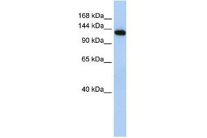 MYBPC2 antibody used at 1 ug/ml to detect target protein. (MYBPC2 抗体  (N-Term))