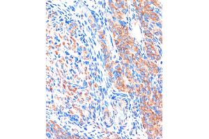 Immunohistochemistry of paraffin-embedded Rat ovary using ME3 Rabbit pAb (ABIN7268384) at dilution of 1:100 (40x lens). (ME3 抗体  (AA 505-604))
