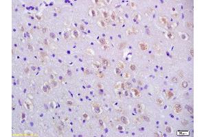 Formalin-fixed and paraffin embedded rat brain labeled with Anti-CCDC11 Polyclonal Antibody, Unconjugated  at 1:200 followed by conjugation to the secondary antibody and DAB staining.