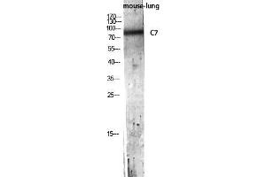 Western Blot (WB) analysis of Mouse Lung lysis using C7 antibody. (C7 抗体)