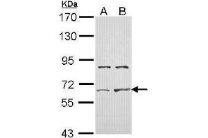 WB Image Sample (30 ug of whole cell lysate) A: Hela B: Hep G2 , 7. (ACVR2A 抗体)
