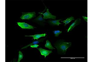 Immunofluorescence of purified MaxPab antibody to S100A10 on HeLa cell.