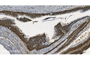 IHC analysis of U2AF65/U2AF2 using anti U2AF65/U2AF2 antibody (ABIN7600794). (U2AF2 抗体  (AA 238-470))