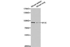 Western blot analysis of extracts of various cell lines, using IFI16 antibody. (IFI16 抗体  (AA 1-300))
