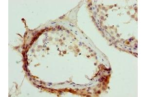 Immunohistochemistry of paraffin-embedded human testis tissue using ABIN7173467 at dilution of 1:100 (TRIM55 抗体  (AA 101-300))