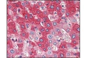 Immunohistochemical analysis of paraffin-embedded human liver tissues using FGFR4 antibody. (FGFR4 抗体)