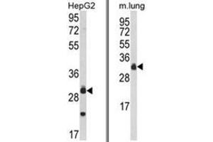 (LEFT) Western blot analysis of MyD88 Antibody (Center) in HepG2 cell line lysates (35ug/lane). (MYD88 抗体  (Middle Region))