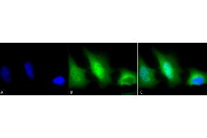Immunocytochemistry/Immunofluorescence analysis using Rabbit Anti-SOD (Cu/Zn) Polyclonal Antibody (ABIN361651 and ABIN361652). (SOD1 抗体)