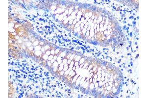 Immunohistochemistry of paraffin-embedded human appendix using V Rabbit mAb (ABIN7271317) at dilution of 1:100 (40x lens). (VAMP8 抗体)