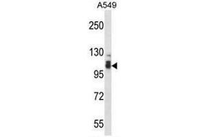 SMEK2 Antibody (C-term) western blot analysis in A549 cell line lysates (35µg/lane). (SMEK2 抗体  (C-Term))