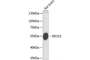 Western blot analysis of extracts of Rat brain using EIF2S3 Polyclonal Antibody at dilution of 1:1000. (EIF2S3 抗体)