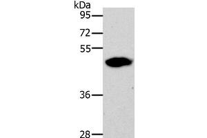 Western Blot analysis of 293T cell using LOX Polyclonal Antibody at dilution of 1:500 (LOX 抗体)