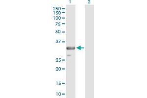 Western Blot analysis of TRADD expression in transfected 293T cell line by TRADD MaxPab polyclonal antibody. (TRADD 抗体  (AA 1-312))