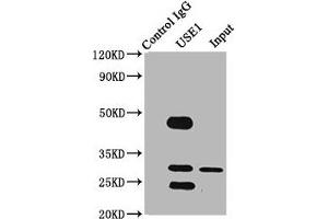Immunoprecipitating USE1 in PC-3 whole cell lysate Lane 1: Rabbit control IgG (1 μg) instead of ABIN7175459 in PC-3 whole cell lysate. (UBE2Z 抗体  (AA 1-146))