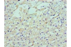 Immunohistochemistry (IHC) image for anti-Low Density Lipoprotein Receptor Adaptor Protein 1 (LDLRAP1) (AA 59-308) antibody (ABIN7158555)