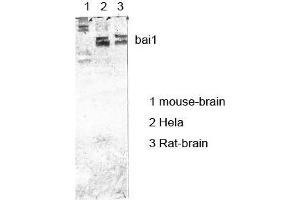 Western Blot (WB) analysis of specific cells using antibody diluted at 1:1000. (BAI1 抗体)
