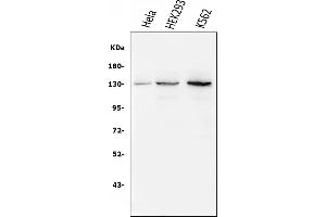 Western blot analysis of BubR1/BUB1B using anti-BubR1/BUB1B antibody (ABIN7600960). (BUB1B 抗体  (AA 26-448))