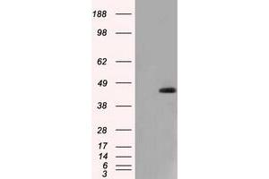 HEK293T cells were transfected with the pCMV6-ENTRY control (Left lane) or pCMV6-ENTRY NXNL2 (Right lane) cDNA for 48 hrs and lysed. (NXNL2 抗体)